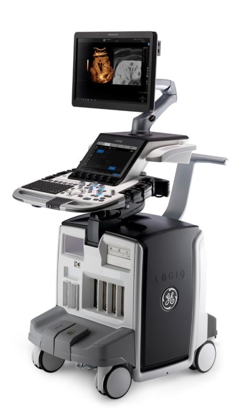 LOGIQ E10
